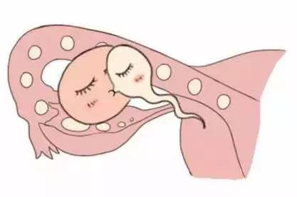 中医妇科